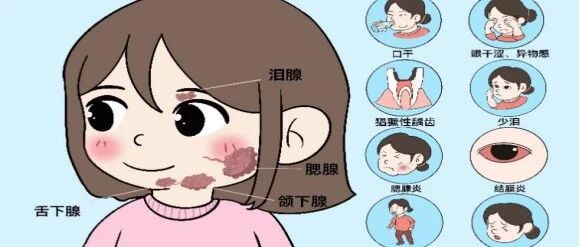 肾内风湿免疫科，您了解多少？